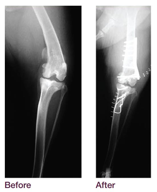 Distal Femoral Osteotomy Plate - Buy distal femoral plate Product on ...